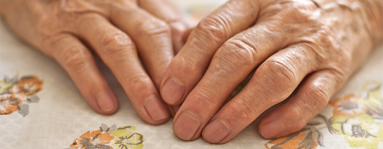 Pain Relief for Arthritis Herkimer, NY