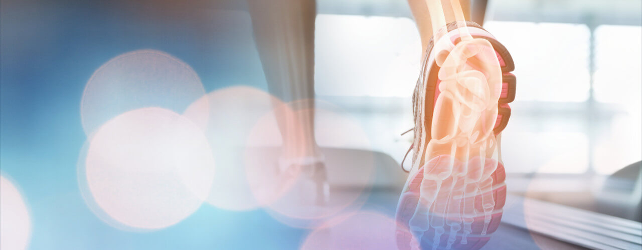 Stress Fractures Herkimer, NY