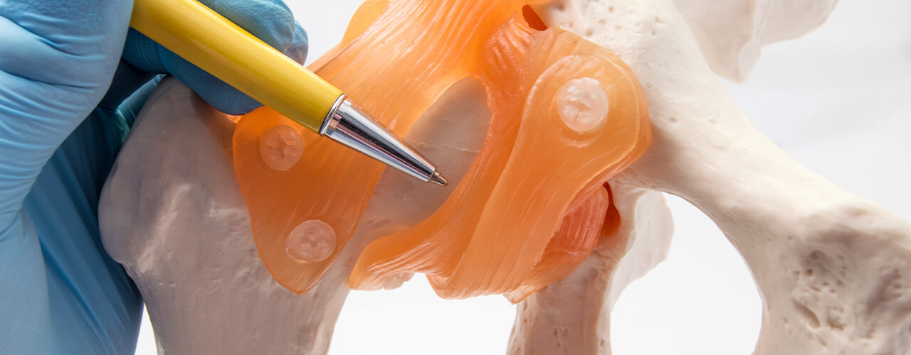 Total Joint Replacement Herkimer, NY